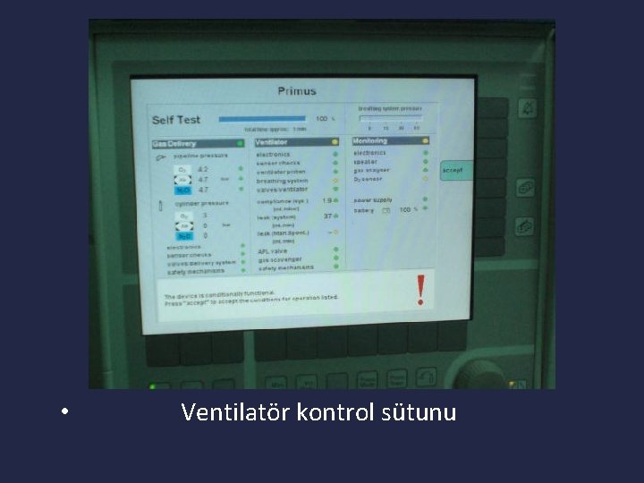  • Ventilatör kontrol sütunu 