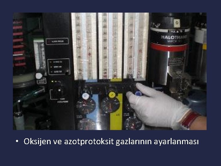  • Oksijen ve azotprotoksit gazlarının ayarlanması 