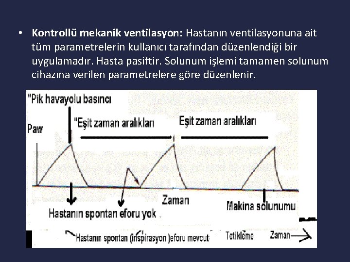  • Kontrollü mekanik ventilasyon: Hastanın ventilasyonuna ait tüm parametrelerin kullanıcı tarafından düzenlendiği bir