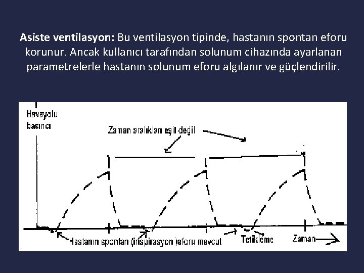 Asiste ventilasyon: Bu ventilasyon tipinde, hastanın spontan eforu korunur. Ancak kullanıcı tarafından solunum cihazında