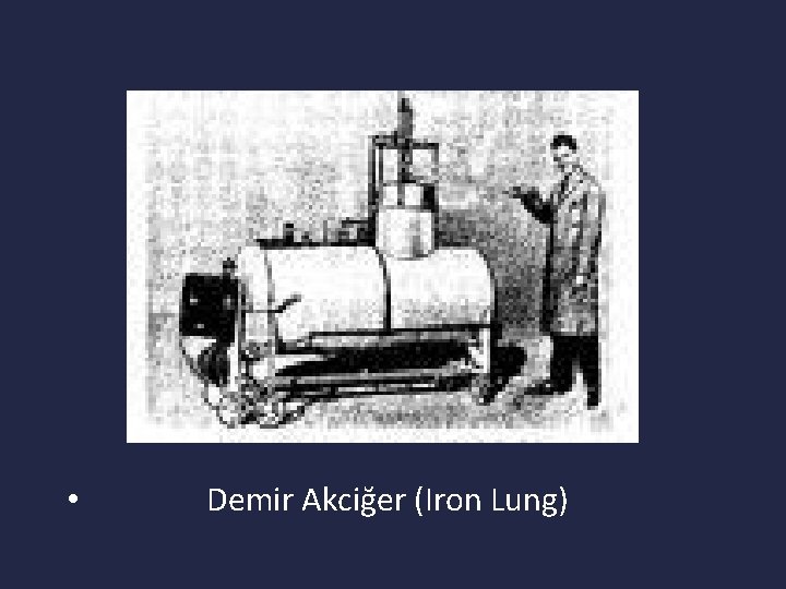  • Demir Akciğer (Iron Lung) 