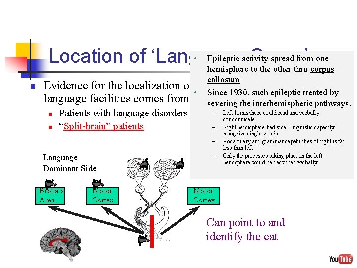  • Epileptic activity spread from one Location of ‘Language Organ’ hemisphere to the