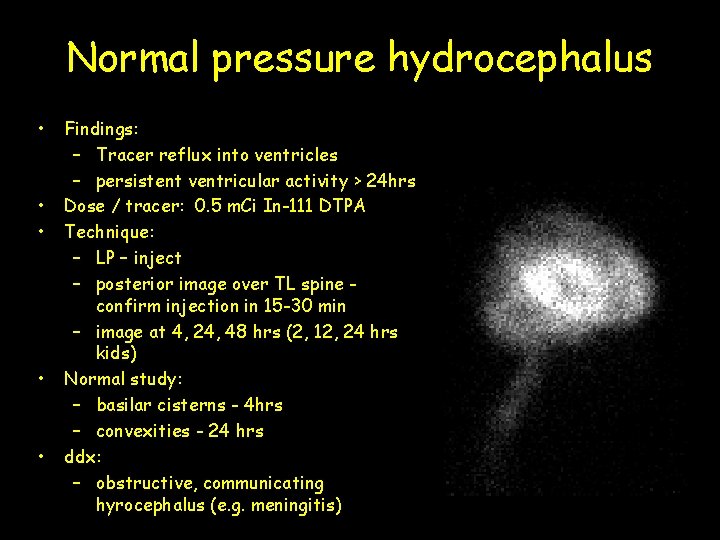 Normal pressure hydrocephalus • • • Findings: – Tracer reflux into ventricles – persistent