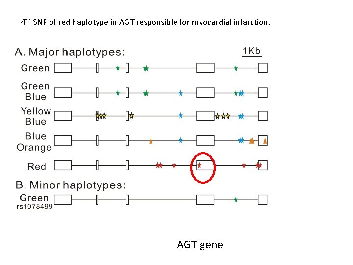 4 th SNP of red haplotype in AGT responsible for myocardial infarction. AGT gene