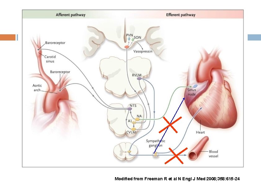 Modified from Freeman R et al N Engl J Med 2008; 358: 615 -24