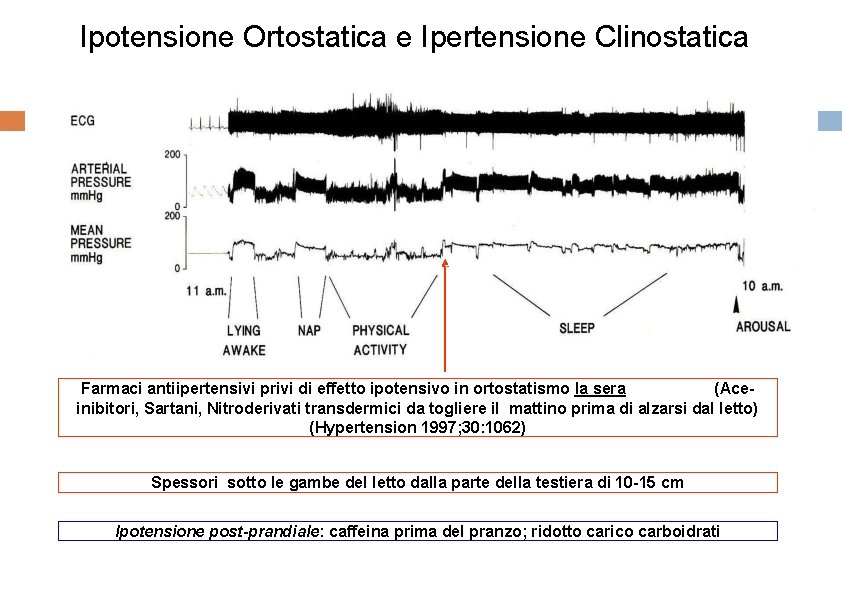 Ipotensione Ortostatica e Ipertensione Clinostatica Farmaci antiipertensivi privi di effetto ipotensivo in ortostatismo la