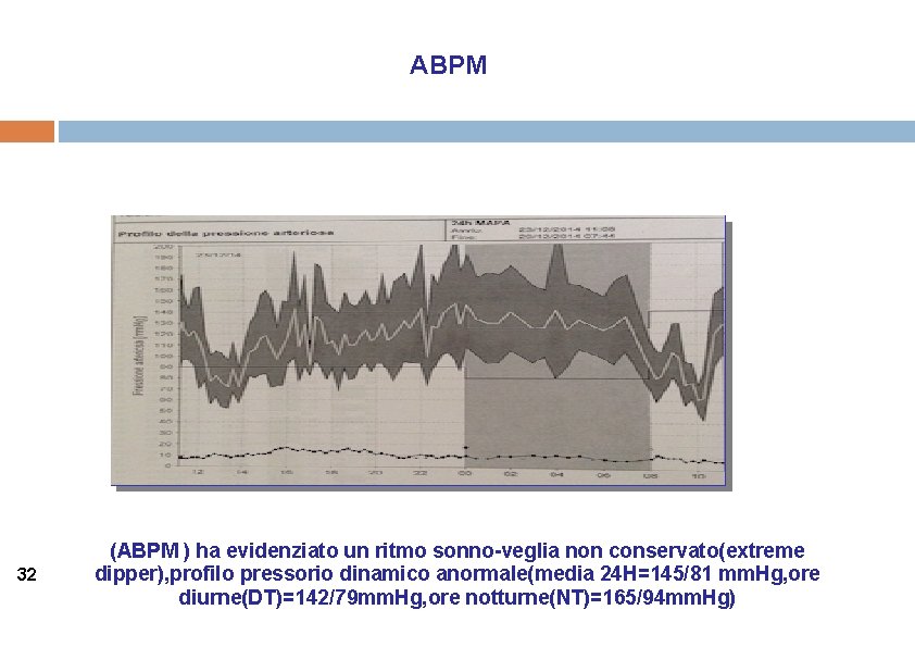 ABPM 32 (ABPM ) ha evidenziato un ritmo sonno-veglia non conservato(extreme dipper), profilo pressorio