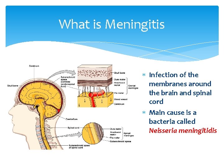 What is Meningitis Infection of the membranes around the brain and spinal cord Main