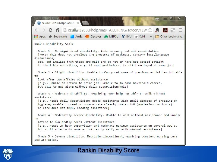 Rankin Disability Score © 2013 MFMER | slide-31 