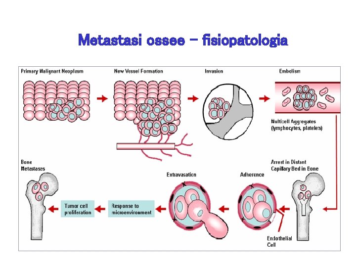 Metastasi ossee - fisiopatologia 