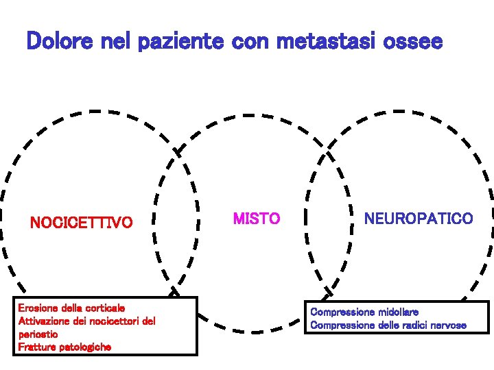 Dolore nel paziente con metastasi ossee NOCICETTIVO Erosione della corticale Attivazione dei nocicettori del