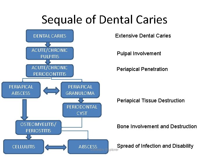 Sequale of Dental Caries DENTAL CARIES Extensive Dental Caries ACUTE/CHRONIC PULPITIS Pulpal Involvement ACUTE/CHRONIC