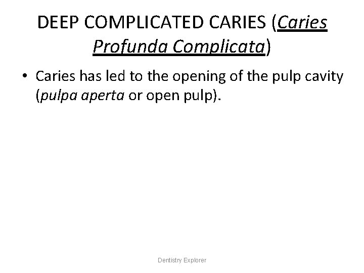 DEEP COMPLICATED CARIES (Caries Profunda Complicata) • Caries has led to the opening of