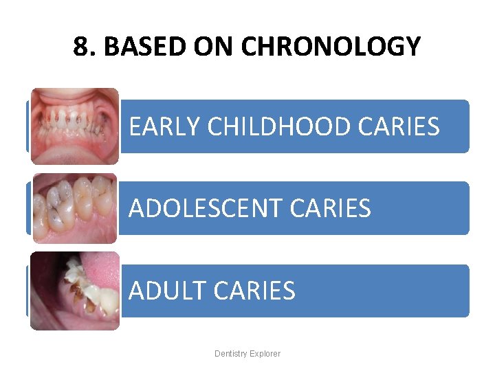 8. BASED ON CHRONOLOGY EARLY CHILDHOOD CARIES ADOLESCENT CARIES ADULT CARIES Dentistry Explorer 