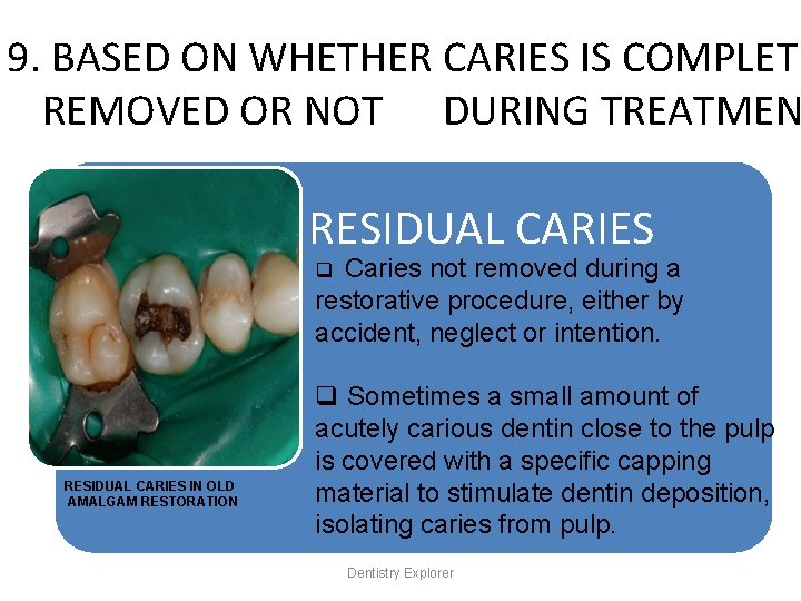 9. BASED ON WHETHER CARIES IS COMPLETE REMOVED OR NOT DURING TREATMEN RESIDUAL CARIES