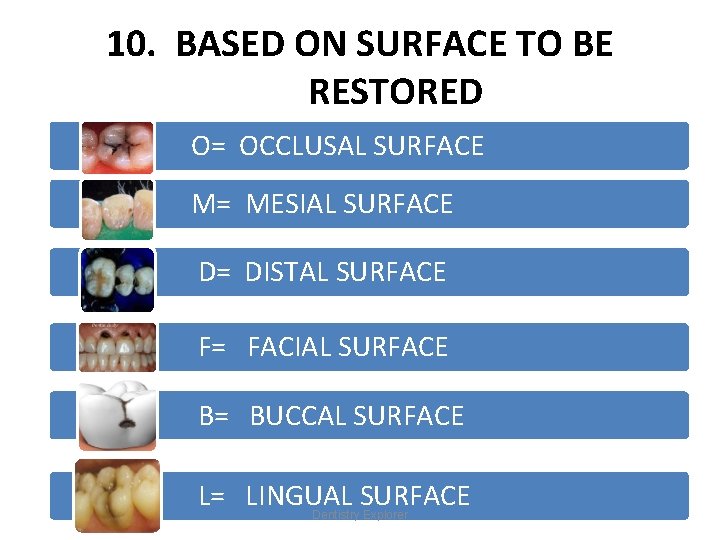 10. BASED ON SURFACE TO BE RESTORED O= OCCLUSAL SURFACE M= MESIAL SURFACE D=