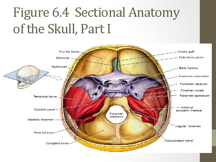 Figure 6. 4 Sectional Anatomy of the Skull, Part I 