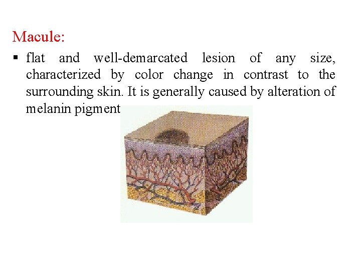 Macule: § flat and well-demarcated lesion of any size, characterized by color change in Macule: § flat and well-demarcated lesion of any size, characterized by color change in