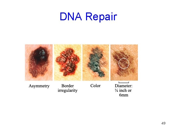 DNA Repair 49 
