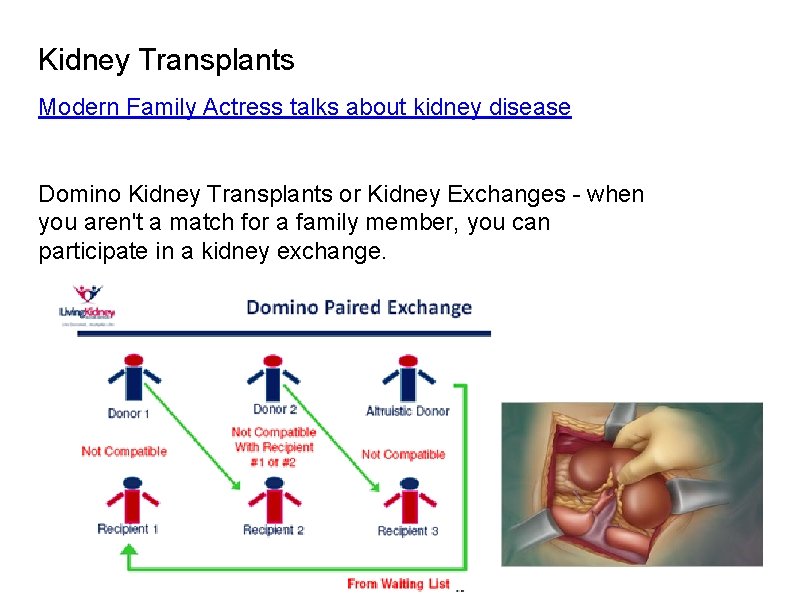 Kidney Transplants Modern Family Actress talks about kidney disease Domino Kidney Transplants or Kidney Kidney Transplants Modern Family Actress talks about kidney disease Domino Kidney Transplants or Kidney