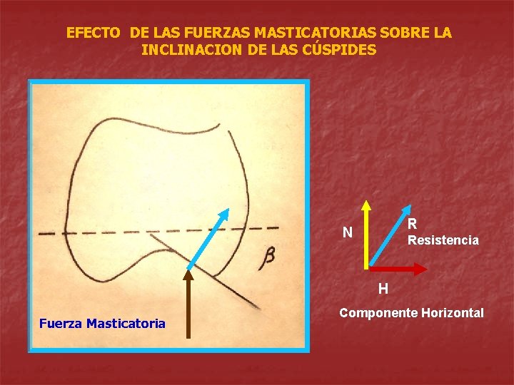 EFECTO DE LAS FUERZAS MASTICATORIAS SOBRE LA INCLINACION DE LAS CÚSPIDES R N Resistencia