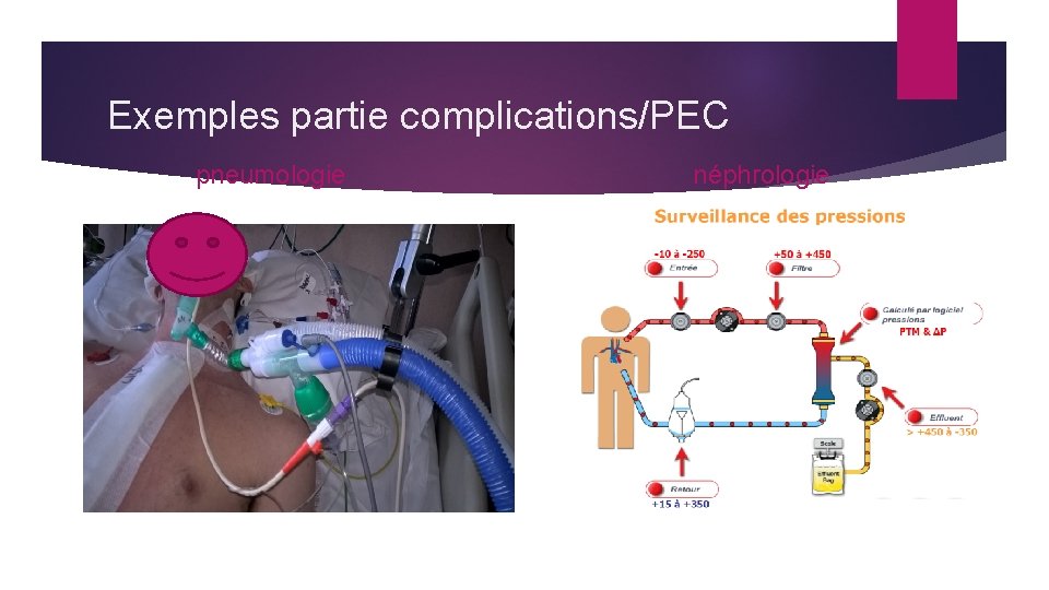 Exemples partie complications/PEC pneumologie néphrologie 