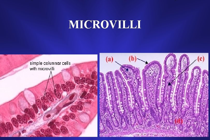 MICROVILLI 