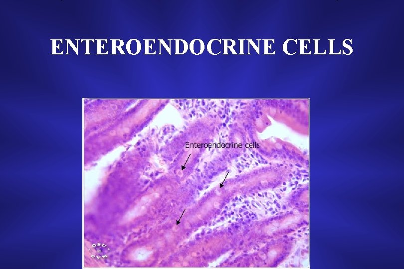 ENTEROENDOCRINE CELLS 