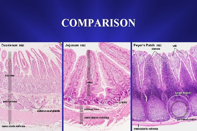 COMPARISON 