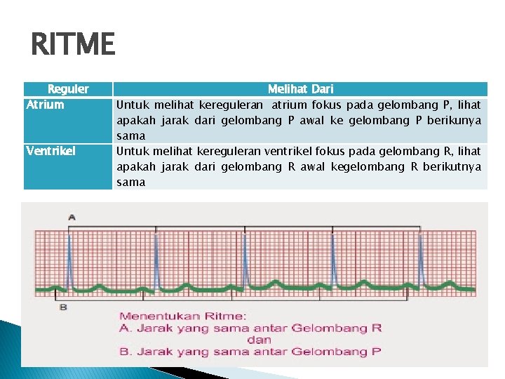 RITME Reguler Atrium Ventrikel Melihat Dari Untuk melihat kereguleran atrium fokus pada gelombang P,