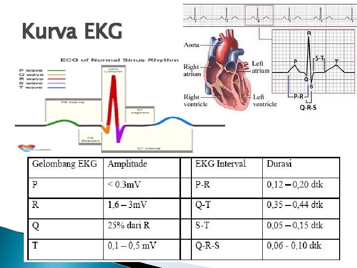 Kurva EKG 