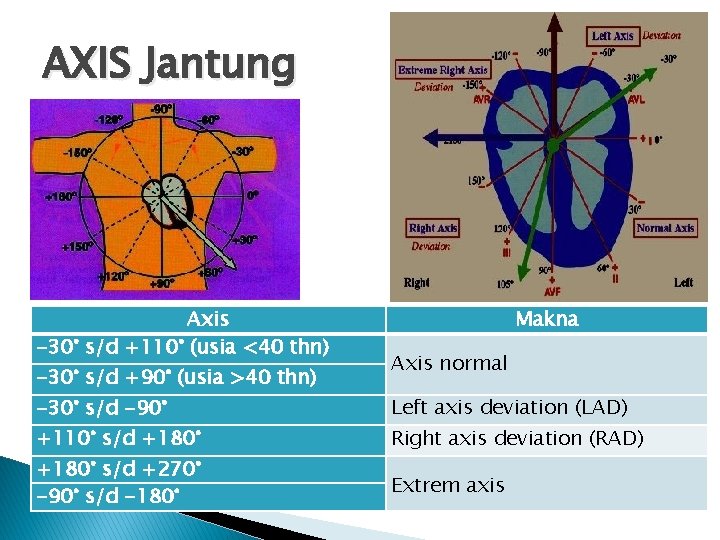 AXIS Jantung Axis -30° s/d +110° (usia <40 thn) -30° s/d +90° (usia >40