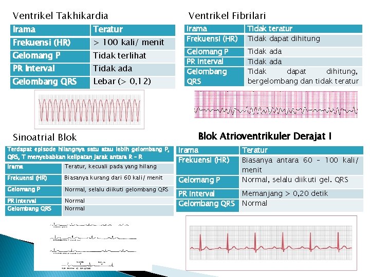 Ventrikel Takhikardia Ventrikel Fibrilari Irama Teratur Frekuensi (HR) > 100 kali/ menit Irama Frekuensi