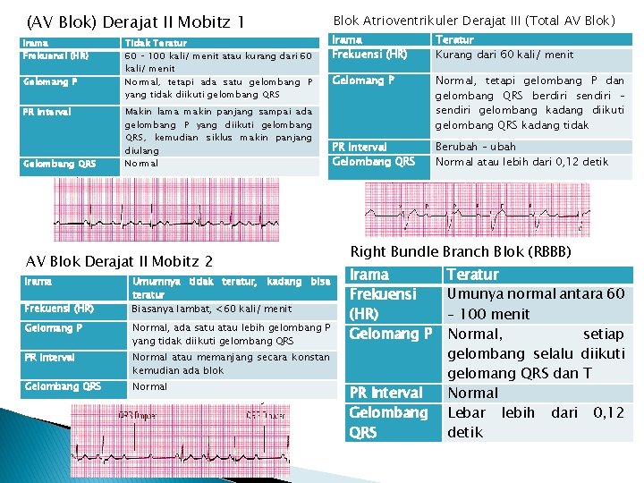 (AV Blok) Derajat II Mobitz 1 Irama Frekuensi (HR) Gelomang P PR Interval Gelombang