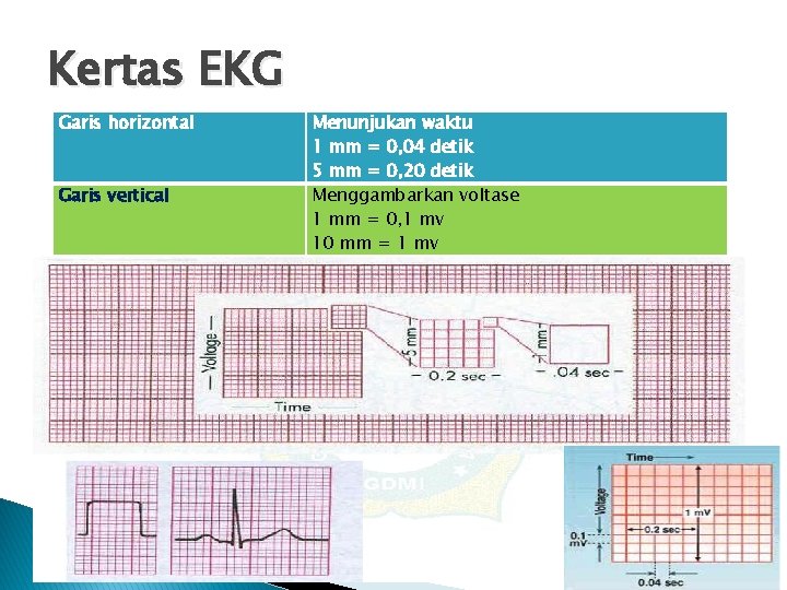 Kertas EKG Garis horizontal Garis vertical Menunjukan waktu 1 mm = 0, 04 detik