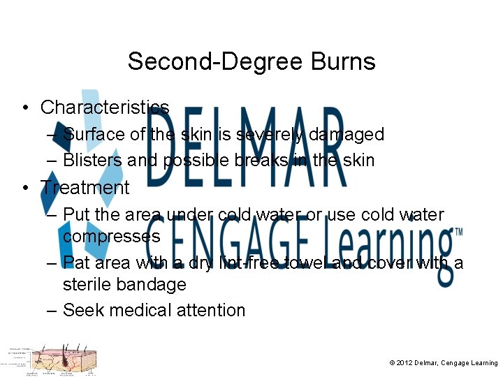 Second-Degree Burns • Characteristics – Surface of the skin is severely damaged – Blisters