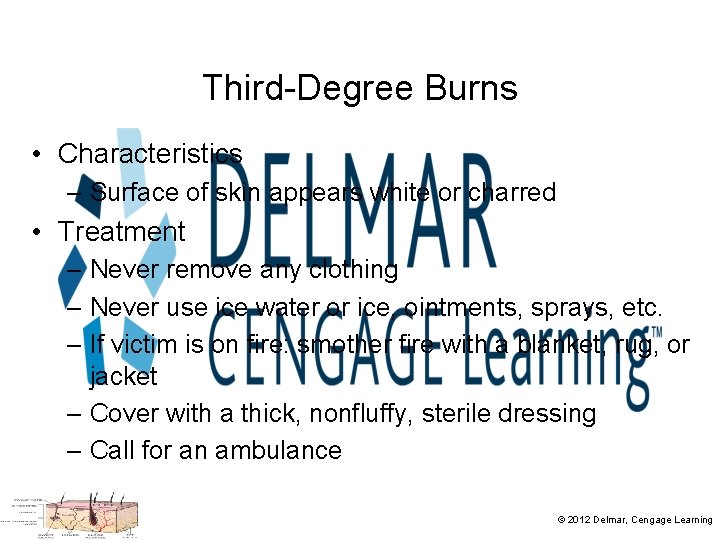 Third-Degree Burns • Characteristics – Surface of skin appears white or charred • Treatment