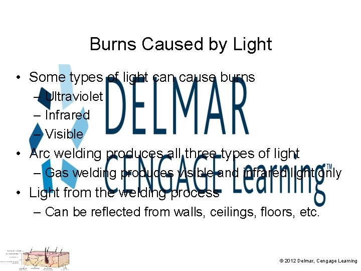 Burns Caused by Light • Some types of light can cause burns – Ultraviolet