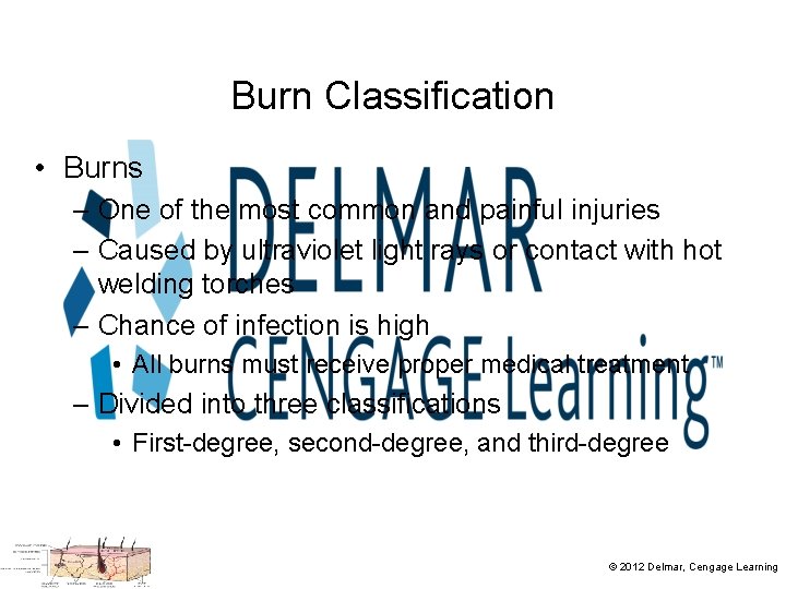 Burn Classification • Burns – One of the most common and painful injuries –