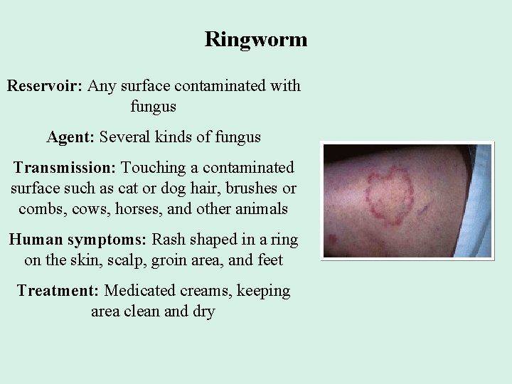 Ringworm Reservoir: Any surface contaminated with fungus Agent: Several kinds of fungus Transmission: Touching