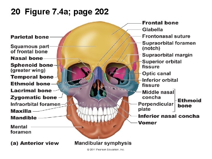 20 Figure 7. 4 a; page 202 