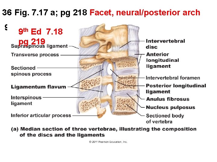 36 Fig. 7. 17 a; pg 218 Facet, neural/posterior arch 9 th Ed 7.