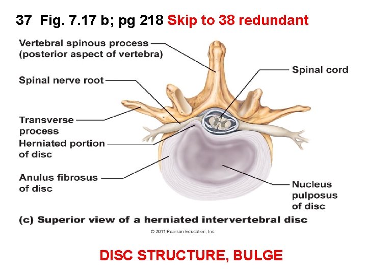 37 Fig. 7. 17 b; pg 218 Skip to 38 redundant DISC STRUCTURE, BULGE