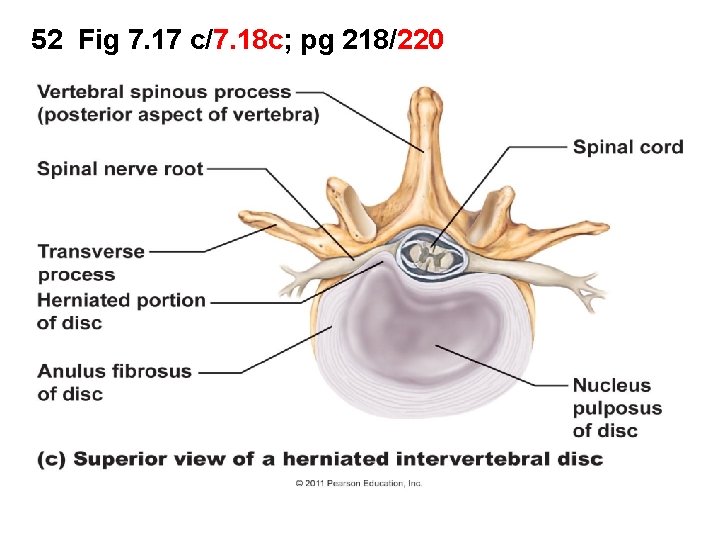 52 Fig 7. 17 c/7. 18 c; pg 218/220 