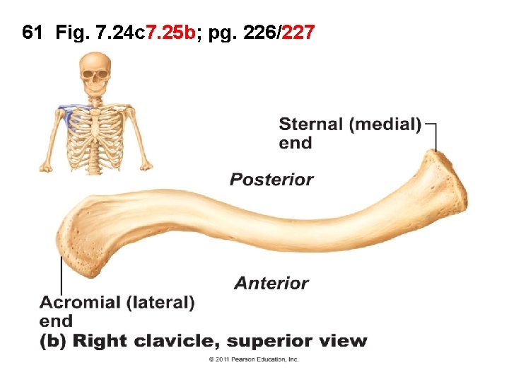 61 Fig. 7. 24 c 7. 25 b; pg. 226/227 