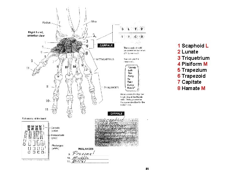 1 Scaphoid L 2 Lunate 3 Triquetrium 4 Pisiform M 5 Trapezium 6 Trapezoid