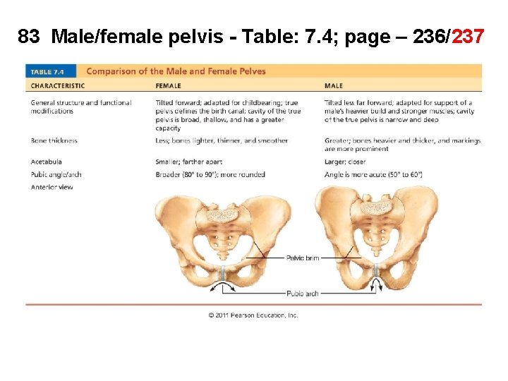 83 Male/female pelvis - Table: 7. 4; page – 236/237 