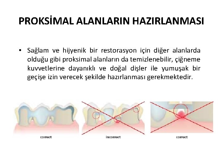 PROKSİMAL ALANLARIN HAZIRLANMASI • Sağlam ve hijyenik bir restorasyon için diğer alanlarda olduğu gibi