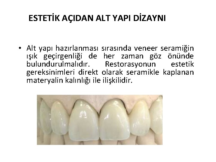 ESTETİK AÇIDAN ALT YAPI DİZAYNI • Alt yapı hazırlanması sırasında veneer seramiğin ışık geçirgenliği
