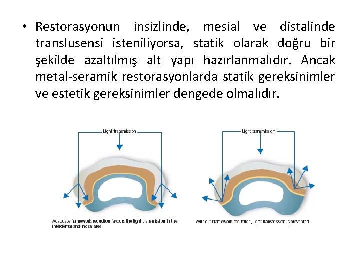 • Restorasyonun insizlinde, mesial ve distalinde translusensi isteniliyorsa, statik olarak doğru bir şekilde